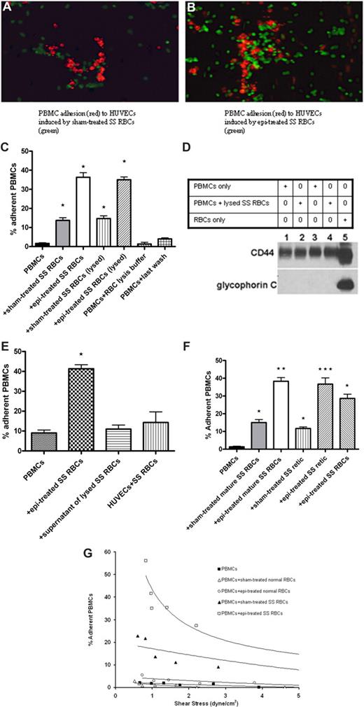 Figure 1. SS RBCs, but not normal RBCs, induced increased PBMC adhesion to HUVECs. (A,B) Sham-treated (A) or epinephrine (epi)–treated (B) SS RBCs (green) were coincubated with PBMCs (red). PBMC-RBC mixtures were then tested for adhesion to HUVECs. Photomicrographs using ×20 magnification show that sham-treated SS RBCs (A), which adhered to some degree to nontreated HUVECs, induced adhesion of PBMCs to HUVECs. Epinephrine-treated SS RBCs (B), which adhered strongly to nonactivated HUVECs, also induced PBMC adhesion to HUVECs. Photomicrograph of adhesion of PBMCs (not coincubated with SS RBCs) is not shown because such PBMCs did not visibly adhere to HUVECs. (C) PBMCs were tested for adhesion to HUVECs in the presence of sham- or epi-treated SS RBCs, or after lysis of sham- or epi-treated SS RBCs. Results are presented as percentage of adherent PBMCs at a shear stress of 1 dyne/cm2. Error bars show SEM of 3 different experiments. *P < .001 compared with unstimulated PBMCs. (D) PBMCs separated from blood obtained from 2 different donors (donor 1, lanes 1 and 2; donor 2, lanes 3 and 4) were analyzed alone (lanes 1 and 3) or after coincubation with ABO-matched SS RBCs (lanes 2 and 4). For PBMC-RBC mixtures, after 30 minutes of incubation, cells were treated with RBC lysis buffer, then washed free of lysed RBCs. Proteins (50 μg protein per lane) obtained from both types of PBMC preparations, as well as RBCs only (lane 5), were then analyzed for the presence of RBC proteins by Western blot using antiglycophorin C and anti-CD44 (a positive control for both RBCs and leukocytes) antibodies, and P3 myeloma protein as a negative control (data not shown). Western blot analysis showed that, after RBC lysis, leukocyte preparations were free of detectable RBC proteins. (E) PBMCs not coincubated with SS RBCs did not significantly adhere to HUVECs previously coincubated with SS RBCs for 15 minutes. Similarly, the supernatant potentially containing free heme and reactive oxygen species obtained from lysed SS RBCs did not induce PBMC adhesion to ECs. Error bars show SEM of 3 different experiments. *P < .001 compared with unstimulated PBMCs. (F) Separation of SS reticulocytes (retic) and mature SS RBCs was accomplished using anti–transferrin receptor mAb 5E9 and goat anti–mouse IgG-coated magnetic microbeads. PBMCs were coincubated with sham-treated mature SS RBCs, epi-treated mature SS RBCs, sham-treated SS retic, epi-treated SS retic, or epi-treated unseparated SS RBCs. Adhesion of PBMCs to HUVECs was then tested. Results are presented as percentage of adherent PBMCs at a shear stress of 1 dyne/cm2. Error bars show SEM of 3 different experiments. *P < .05 compared with unstimulated PBMCs; **P < .001 compared with PBMCs coincubated with sham-treated mature SS RBCs; ***P < .001 compared with PBMCs coincubated with sham-treated SS retic. (G) Adhesion of PBMCs to HUVECs after coincubation with sham- or epi-treated normal RBCs versus sham- or epi-treated SS RBCs, respectively. One representative experiment is presented (n = 3).