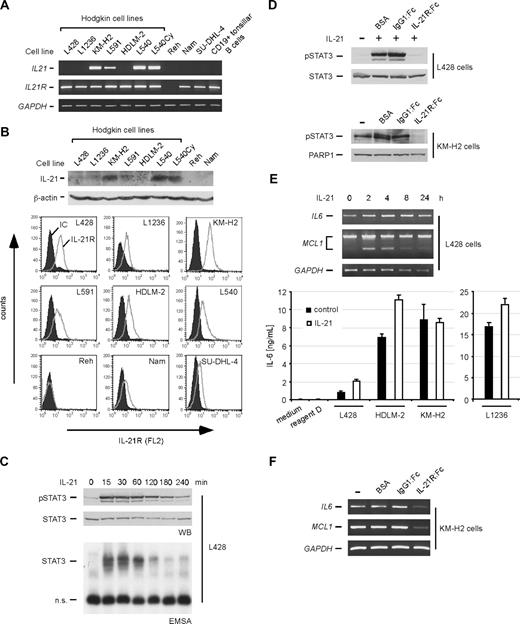 Figure 1. Expression and functional activity of the IL-21/IL-21R system in HRS cell lines. (A) RT-PCR analyses of IL21 and IL21R mRNA expression in Hodgkin (L428, L1236, KM-H2, L591, HDLM-2, L540, L540Cy) and non-Hodgkin (Reh, Namalwa, SU-DHL-4) cell lines and purified CD19+ tonsillar B cells. Expression of GAPDH was analyzed as a control. (B) Protein expression of IL-21 and IL-21R in various cell lines. Top panels show protein expression of IL-21 in the indicated cell lines, which was analyzed by Western blot in whole-cell extracts. Expression of β-actin was analyzed as a control. Bottom panels show analysis of IL-21R expression by flow cytometry in HRS (L428, L1236, KM-H2, L591, HDLM-2, L540) and non-Hodgkin (Reh, Namalwa, SU-DHL-4) cell lines. IC indicates isotype control. (C) Induction of STAT3 activity in L428 cells following treatment with rhIL-21. L428 cells were cultured for 12 hours in medium containing 0.5% FCS. Thereafter, cells were stimulated with 100 ng/mL rhIL-21, and whole-cell extracts were prepared at the indicated times. Extracts were analyzed by Western blot for phospho-STAT3 (pSTAT3) and, as a control, STAT3 expression (top panels). STAT3 DNA-binding activity was analyzed in whole-cell extracts by EMSA (bottom panel). (D) Inhibition of IL-21 by IL-21R:Fc. Top panels: to verify functionality of IL-21R:Fc, HRS L428 cells were left untreated or treated for 15 minutes with 20 ng/mL rhIL-21 preincubated with BSA (carrier for the :Fc constructs), or with 30 μg/mL of the control IgG1:Fc or the specific IL-21R:Fc construct. Thereafter, whole-cell extracts were analyzed by Western blot for pSTAT3 and STAT3 expression. Bottom panels: KM-H2 cells with constitutive STAT3 phosphorylation were left untreated, incubated with BSA, or treated with 50 μg/mL IgG1:Fc (control) or IL-21R:Fc, as indicated. After 6 hours, nuclear extracts were prepared and analyzed by Western blot for pSTAT3 and, as a control, PARP-1 expression. (E) Regulation of STAT3 target genes following stimulation of HRS cell lines with rhIL-21. Top panels: L428 HRS cells were stimulated with rhIL-21 as described in panel D. At the indicated times, mRNA was prepared and analyzed by RT-PCR for expression of IL6, MCL1, and, as a control, GAPDH. Bottom panel: measurement of secreted IL-6 by ELISA following stimulation with rhIL-21. The cell lines L428, L1236, HDLM-2, and KM-H2 were cultured in 1% FCS and stimulated every 8 hours with rhIL-21. After 24 hours, supernatants were analyzed by an IL-6–specific ELISA. The amount of IL-6 in the supernatants is shown in nanograms per milliliter. As controls, standard medium and the reagent diluent for the standard (reagent D) were included. Error bars denote SD. (F) KM-H2 cells were treated as described in panel D. After 6 hours, mRNA was prepared and analyzed by RT-PCR for expression of IL6, MCL1, and, as a control, GAPDH.