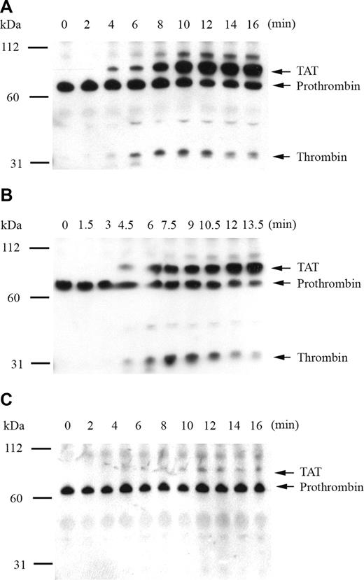 Figure 2. Analysis of tissue factor–stimulated thrombin generation by Western blot in factor IX–deficient plasma supplemented with 5% recombinant factor IX wild-type, R170A, and R233A. Thrombin generation was initiated with 0.2 pM of human tissue factor, 8.3 μM of PC:PS vesicles, and 40 μg/mL of CTI (plasma concentrations) in factor IX-deficient plasma supplemented with 5% recombinant factor IX wild-type (A), R170A (B), and R233A (C). Individual reactions were quenched over time with loading buffer containing 5 M of urea and analyzed by 10% SDS-PAGE under nonreducing conditions as described in “The time course of plasma thrombin generation by Western blotting.” Proteins transferred to Immobilon-P were detected with a polyclonal sheep anti–human thrombin primary antibody, followed by a peroxidase-conjugated affinity-purified donkey anti–sheep IgG, and subsequent development of signal with chemiluminescent substrate. Prothrombin indicates prothrombin/meizothrombin band; TAT, thrombin-antithrombin complex.