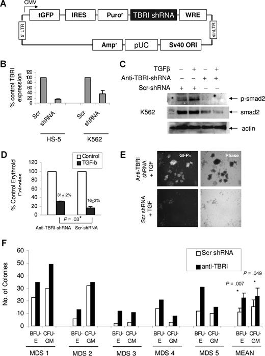 Figure 2. Down-regulation of TGF beta receptor I (TBRI) can inhibit smad2 activation in hematopoietic cells and stimulate MDS hematopoiesis. GFP-expressing lentiviral-based shRNA against TBRI (A) was used to knock down TBRI in hematopoietic cells. qPCR shows decrease in TBRI mRNA expression after lentiviral shRNA-TBRI infection in bone marrow stromal (HS-5) and leukemia cells (K562) compared with scrambled control (B). K562 cells with stable expression of TBRI-shRNA lentivirus show decreased smad2 phosphorylation after TGF stimulation (C). Primary CD34+ progenitors were electroporated with GFP coexpressing anti–TBRI-shRNA construct and sorted after 48 hours. GFP-positive cells were grown in methylcellulose with cytokines, and erythroid colonies were counted after 14 days. TBRI-shRNA–transfected progenitors were less inhibited by TGF-β compared with cells transfected with scrambled control shRNA (31% colonies/control vs 16% colonies/control). Expressed as means (± SEM) of 4 independent experiments (P = .03, 2-tailed t test) (D). CD34+ cells transfected with anti–TBRI-shRNA also formed bigger colonies in the presence of TGF-β1 compared with controls (E; Nikon, 40×). Primary bone marrow–derived mononuclear cells from 5 patients with MDS were transfected with shRNA targeting TBRI and control, and equal numbers of cells (for each individual patient) were grown in methylcellulose with cytokines. Erythroid (BFU-E) and myeloid (CFU-GM) colonies were counted after 14 days of culture and demonstrated an increase after anti–TBRI-shRNA transfection (significance between means calculated by 2-tailed t test) (F).