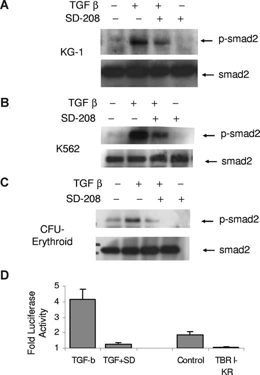 Figure 3. SD-208 is an inhibitor of TGF-β signaling in hematopoietic cells. Leukemic cells (K562 and KG-1) and primary hematopoietic progenitors at the colony-forming unit–erythroid stage of maturation (CFU-E) were treated with TGF-β1 (20 ng/mL) in the presence and absence of SD-208 (.5 μM) and assessed for smad2 phosphorylation by immunoblotting. SD-208 pretreament (1 hour) led to attenuation of activation/phosphorylation of smad2 (A-C). Bone marrow stroma–derived cells (HS-5) were transfected with plasmids expressing smad binding 3TP-luciferase and β-galactisidose (transfection control) and stimulated with TGF-β1 in the presence and absence of SD-208 (dose .5 μM). TGF-β1–induced control-normalized luciferase activity was potently inhibited by SD-208. A kinase-null mutant of TGF-β receptor I (TBRI-KR) was used a positive control (D). Error bars represent SEM.