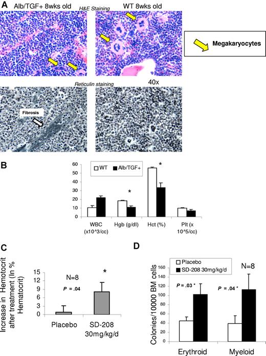Figure 5. SD-208 can improve anemia in a murine model of TGF-β1–driven bone marrow failure. Mice transgenic for alb/TGF-β were killed at 8 weeks of age and their bone marrows were stained for histology (hematoxylin and eosin and reticulin stain). Transgenic mice demonstrated dysplastic micromegakaryocytes and patchy fibrosis. (A) Blood counts were analyzed at 3 weeks by Advia (Bayer) counter, and alb/TGF+ transgenic mice were found to be significantly anemic compared with WT controls (n = 4; means ± SEM; Nikon, 40×) (B). alb/TGF+ mice were treated with either SD-208 (30 mg/kg per day) or vehicle (placebo, daily) by gastric lavage for 14 days. Blood counts were done on the 14th day and revealed a significant rise in hematocrit after SD-208 treatment (C). The mice were killed and bone marrow cells were plated in methylcellulose with Epo (for BFU-E colonies) and IL-3, IL-6, and SCF (for CFU-GM colonies). SD-208 treatment led to a significant increase in both erythroid and myeloid colony-forming potential compared with placebo (n = 8; means ± SEM; 2-tailed t test; D).