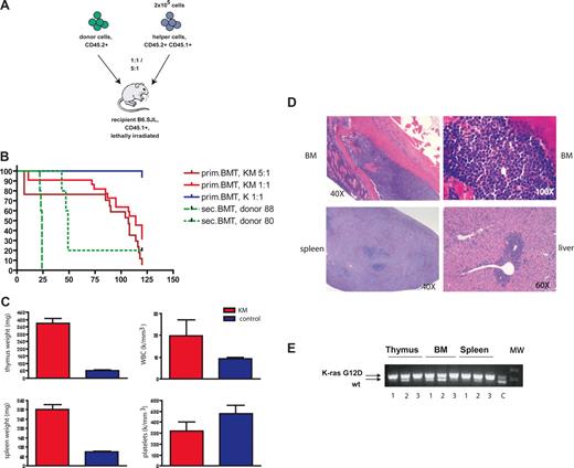 Figure 1. Mice transplanted with K-RasG12D–expressing bone marrow cells develop an aggressive T-cell disease. (A) Schematic illustration of the bone marrow transplantation strategy. (B) Kaplan-Meier survival plot of mice transplanted with BM cells derived from K-RasG12D/+Mx1-Cre+ (KM) and K-RasG12D/+ (K) together with 2 × 105 helper cells or with 106 cells derived from the thymi of 2 different diseased animals (donors 9988 and 9980; n = 5 each). Cumulative survival was plotted against days after BMT. KM 5:1 (n = 17) and KM 1:1 (n = 22) developed an aggressive T-cell disease with a median survival of 107 and 114 days, respectively. Sixteen of 17 K-mice were healthy during observation; 1 mouse died of a spontaneous thymic lymphoma. (C) Hematologic and pathologic data of diseased mice. KM mice have increased weight of thymus and spleen, elevated weight blood cell counts, and mild thrombocytopenia. (D) Histopathologic sections of BM (first row, original magnification 40×, left, original magnification 100×, right; hematoxylin and eosin), spleen (bottom left, original magnification 40×; hematoxylin and eosin), and liver (bottom right, original magnification 60×; hematoxylin and eosin) from a representative mouse with T-ALL. Diseased mice show infiltration of lymphoblasts in BM and spleen with destruction of normal architecture as well as extramedullary hematopoiesis in liver. (E) Cre-mediated activation of the oncogenic K-Ras allele. PCR for WT and activated (Δ) K-Ras allele demonstrates the presence of the activated K-Ras allele in thymus, bone marrow, and spleen of 3 representative patients with T-ALL. C indicates control DNA from an patient with KM+-induced MPD; MW, molecular weight marker.