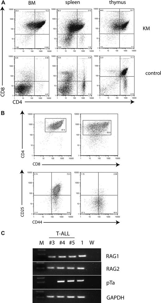 Figure 2. Malignant T cells are CD4/CD8 double-positive and aberrantly express early markers of T-cell development. (A) Flow cytometric analysis of single-cell suspensions of BM, spleen, and thymus of a representative diseased mouse demonstrates a CD4/CD8 double-positive population in all 3 tissues, with some cells becoming single-positive for CD8. The percentages of cells are indicated in each quadrant. (B) Flow cytometric analysis of single-cell suspensions of the thymus from 2 diseased mice demonstrates variable phenotypes. Plots were gated on live cells and stained for CD4 and CD8 (top panel). The gated tumor cell population was analyzed for the expression of CD25 and CD44 (bottom panel). The percentages of cells of interest are indicated. (C) T-ALL cells express RAG1, RAG2, and pre–T-α. Tumor and control cDNA was amplified using primer for RAG1, RAG2, pre–T-α, and GAPDH, electrophoresed through a 2% agarose gel and stained with ethidium bromide. M indicates molecular weight marker; 1, KM donor 1; and W, water.
