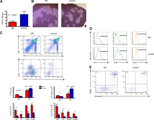 Figure 4. Primary, oncogenic K-Ras–expressing mice have a severe block in differentiation during early T-cell development. (A) Decreased thymic cellularity in oncogenic K-Ras–expressing mice (KM). Total thymocyte number of 4-week-old KM mice is reduced (P = .025) compared with control mice (8 days after pI-pC induction). (B) Histopathologic sections of the thymus of a primary mouse expressing oncogenic K-Ras (left) compared with normal control (right), 8 days after pI-pC induction (original magnification 40×; hematoxylin and eosin) show a perturbed thymic architecture with an increase in stromal tissue in the former. Shown is 1 representative example. (C) Expression of oncogenic K-Ras is associated with a decrease of the DP population and an increase of DN1 cells. Single-cell suspension from thymi of 4-week-old KM (n = 7) and control (n = 7) mice, 8 days after pI-pC induction, were prepared and stained for CD4 and CD8. CD25 and CD44 expression was analyzed gating on DN, DP, CD8 single-positive (SP), and CD4 SP populations. Compared with normal controls, DP cells were significantly reduced (P = .027, shown as percentage of live cells and P = .012 for total cell numbers), whereas DN1 and CD8 SP populations were significantly increased. Shown is 1 representative experiment of 7 independent experiments (top panel), and bar diagrams represent combined results (bottom: left, percentage of live cells; right, total cell number). DN indicates double-negative; DP, double-positive; and SP, single-positive. (D) DN cells of KM mice show reduced expression of CD3, TCR-β, and TCR-γ/δ. Histograms were gated on the DN population of thymocytes derived from KM or control mice. Shown is a representative example of 6 for each experiment. (E) Primary thymocytes exhibit enhanced apoptosis. DN-gated cells were analyzed with 7AAD and annexin V staining. Data are a representative of 3 independent experiments.