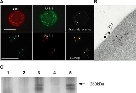Figure 5. CR1 colocalizes and coimmunoprecipitates with FAP-1 in human erythrocytes. (A) Colocalization by fluorescence microscopy. Fixed (top row) or fresh (bottom row) erythrocytes were incubated with anti-CR1 mAb 1F11 followed by AlexaFluor-488 goat anti–mouse Ab. After fixation, quenching, and permeabilization, anti–FAP-1 or control Ab was added, followed by AlexaFluor-594 donkey anti–rabbit Ab. Cells were mounted on a slide and images were recorded using the appropriate filters. Bar represents 5 μm. (B) Colocalization by EM-immunogold method. Fresh erythrocytes were reacted with anti-CR1 mAb and then incubated with 18 nm gold conjugated goat anti–mouse antibody as described in “Methods.” Cells were fixed, embedded, sectioned, and then stained with either control Ab (not shown) or anti–FAP-1 rabbit anti-serum (hPTP1E17) followed by 10 nm gold goat anti-rabbit antibody. (C) Fresh (lane 3) or CR1 cross-linked erythrocytes (anti-CR1 mAb YZ1 + goat anti–mouse IgG Ab (lane 5) were lysed and CR1 precipitated with YZ1 coupled to proteins A + G beads (lane 3) or donkey anti–goat coupled to protein A + G beads (lane 5). Controls included: lane 1, erythrocytes + mIgG1 control Ab + protein A + G beads; lane 2, erythrocytes + protein A + G beads; lane 4, erythrocytes + goat anti–mouse coupled to protein A + G beads. The immunoprecipitates were resolved by SDS-PAGE blotted on nitrocellulose membrane and developed with rabbit anti–FAP-1 antiserum.17 FAP-1 band (arrow) was precipitated in erythrocytes both before (lane 3) and after (lane 5) CR1 cross-linking. Control lanes 1, 2, and 4 were negative. The experiment was repeated 3 times, twice with these results.