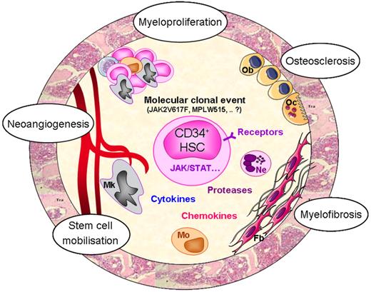 Figure 2. Putative mechanisms responsible for PMF pathogenesis. Whereas the initial molecular defect at the origin of the pathological clone is still unknown, alteration of tyrosine kinase–related signalization likely participates in the amplification of the hematopoietic clone as attested by the presence of mutations in the JAK2 and MPL genes in a proportion of PMF patients. Altered interactions between clonal CD34+ cells and stromal cells in the hematopoietic environment would result in an increased cytokine production by the clonal hematopoietic cells and especially by dystrophic megakaryocytes and monocytes. Increased production of hematopoietic, fibrogenic, and angiogenic growth factors would maintain hematopoietic cell proliferation (myeloproliferation) and stimulate myelofibrosis, osteosclerosis, and neoangiogenesis through activation of stromal and endothelial cells. Egress of CD34+ cells from the bone marrow (stem cell mobilization) would result from several mechanisms including chemokines/receptor alterations and protease release from activated neutrophils. HSC indicates hematopoietic stem cell; Mk, megakaryocyte; Mo, monocyte; Ne, neutrophil; Fb, fibroblast; Ob, osteoblast; and Oc, osteoclast.