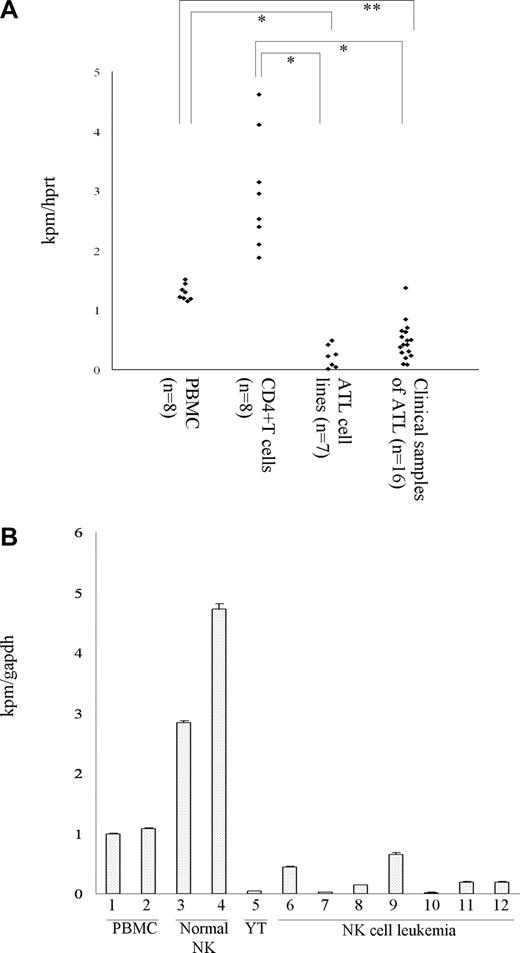 Figure 1. Quantitative analysis of Kpm/Lats2 mRNA in clinical samples and cell lines. (A) The amount of Kpm/Lats2 mRNA was measured in ATL cell lines, ATL clinical samples, normal PBMCs, and normal CD4+ T cells. Data normalized to hprt are shown representatively in scale that the value for normal PBMC is 1. Normalization to gapdh gave similar results. The highest one among the ATL cell lines represents ED-40515+. Analyses were performed in duplicate independently 3 times and representative data are shown (Welch t test: *P < .001; **P < .005). (B) The amount of Kpm/Lats2 mRNA was measured in NK cell line (YT), NK cell leukemia clinical samples, normal PBMCs (lanes 1-2), and normal CD3−56+ NK cells (lanes 3-4), NK cell line (YT; lane 5), and NK cell leukemia clinical samples (lane 6-12). Data normalized to gapdh are shown as mean plus or minus SD in scale that the value for normal PBMCs (lane1) is 1. Normalization to hprt gave similar results. Analyses were performed in triplicate independently twice, and representative data are shown.