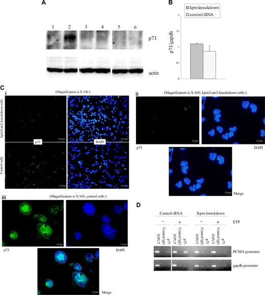 Figure 4. Stabilization of p73 after treatment with ETP is insufficient in Kpm/Lats2-knockdown cells. (A) Western blotting analysis with anti-p73 in whole-cell lysate of control KG-1a cells without treatment of ETP (lane 1) or with treatment of 0.03 μg/mL ETP for 3 days (lane 2), Kpm/Lats2-knockdown KG-1a cells without treatment of ETP (lane 3), or with treatment of 0.03 μg/mL ETP for 3 days (lane 4), and p73-knockdown KG-1a cells without treatment of ETP (lane 5) or with treatment of 0.03 μg/mL ETP for 3 days (lane 6). Twice, independent experiments were performed and representative data are shown. (B) Expression of p73 mRNA in Kpm/Lats2-knockdown KG-1a or control cells treated with 0.03 μg/mL ETP for 3 days was measured by real-time PCR analysis. Data normalized to gapdh are shown as mean plus or minus SD in scale that the value for KG-1a wild-type cells with the same treatment is 1. The analyses were performed in triplicate independently twice and representative data are shown as mean plus or minus SD. (C) Immunofluorescence staining for p73 and DAPI. Kpm/Lats2-knockdown KG-1a cells and control cells treated with 0.1 μg/mL ETP were stained with anti-p73 Ab or DAPI and observed with a fluorescence microscope at the magnification of ×100 or ×600. Four independent experiments were performed and representative data are shown. (D) ChIP assay. ChIP assay was performed as described in “Chomatin immunoprecipatation assay.” p73 was recruited to PUMA gene promoter in control cells but not in Kpm/Lats2-knockdown cells after the treatment with 0.03 μg/mL ETP for 60 hours. Two independent experiments were performed and representative data are shown.