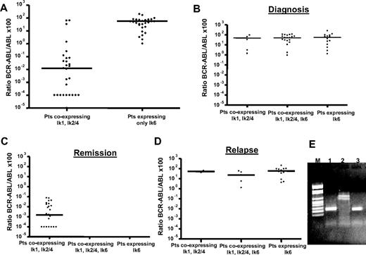 Figure 3. Comparison between the BCR-ABL/ABL ×100 ratios of the patients who expressed the Ik1, Ik2 DNA-binding isoforms alone and patients expressing the Ik6 dominant-negative isoform alone, independent of the clinical disease status. (A)There was a strong correlation between Ik6 expression and BCR-ABL transcript levels (P < .001). Expression pattern of Ikaros isoforms at different checkpoints during treatment with tyrosine kinase inhibitor: at diagnosis (B), during remission (C), and at the time of relapse (D) (both hematologic/cytogenetic and molecular). In patients with relapse and high levels of BCR-ABL transcript, Ik6 was the major isoform expressed. (E) RT-PCR analysis at baseline (lane 1), during remission (lane 2), and at the time of relapse (lane 3).