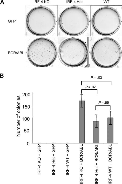 Figure 2. IRF-4 deficiency facilitates BCR/ABL transformation of B-lymphoid progenitors. Bone marrow from IRF-4 WT, IRF-4 Het, or IRF-4 KO mice was infected with MSCV retrovirus containing sequences for BCR/ABL-IRES-GFP or GFP, then triplicates of 2 × 106 cells were plated in soft agar media in the absence of cytokines. Colonies were counted after 10 days. Representative soft agar plates and quantitation of the corresponding colonies are presented in panel A and panel B, respectively.