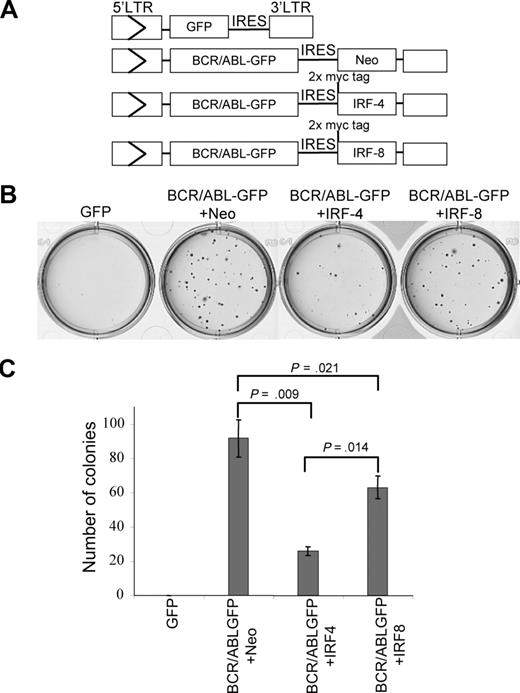Figure 4. IRF-4 suppresses BCR/ABL–stimulated B-lymphoid colony formation. Bone marrow cells freshly isolated from mice were infected with titer-matched MSCV constructs containing BCR/ABL-GFP+ Neo, BCR/ABL-GFP+ IRF-4, BCR/ABL-GFP+ IRF-8, or GFP (A), then triplicates of 2 × 106 cells were plated in soft agar media in the absence of cytokines. Colonies were counted after 10 days. Representative soft agar plates and quantitation of the corresponding colonies are presented in panel B and panel C, respectively.