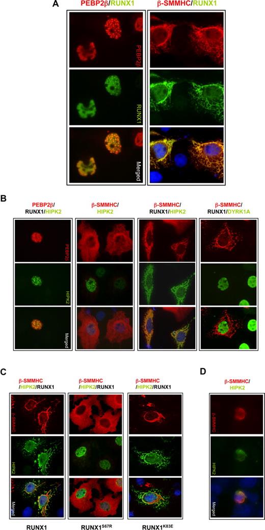 Figure 6. Cytoplasmic sequestration of HIPK2 in filamentous structures formed by interaction between RUNX1 and PEBP2-β-SMMHC. (A) PEBP2-β-SMMHC forms filament-like cytoplasmic structures in the presence of RUNX1. COS-7 cells were transiently transfected with RUNX1 along with PEBP2-β or PEBP2-β-SMMHC and analyzed for RUNX1 (green) and PEBP2-β or PEBP2-β-SMMHC (red) by indirect immunofluorescence with anti-RUNX1 or -PEBP2-β antibodies accordingly, followed by Alex 488- or 594-conjugated secondary antibodies, respectively. Merged images showing overlapping localization are shown in the third panel. The nuclei were counterstained with DAPI (blue). All images: original magnification ×1000. (B) HIPK2 is specifically sequestrated in pronounced cytoplasmic RUNX1/PEBP2-β-SMMHC complexes. FLAG-HIPK2 is coexpressed together with wild-type PEBP2-β and RUNX1 (first column), β-SMMHC alone (second column), β-SMMHC and RUNX1 (third column), in COS-7 cells. Negative control experiment was performed using FLAG-DYRK1A (fourth column). FLAG-HIPK2 (green), FLAG-DYRK1A (green), PEBP2-β (red), or β-SMMHC (red) proteins were visualized by indirect immunofluorescence as described for panel A using anti-FLAG or -PEBP2-β antibodies, respectively. Merged images showing nuclei counterstained with DAPI (blue) are shown in the lowest panels. (C) Sequestration of HIPK2 to RUNX1/β-SMMHC complex is dependent on RUNX1 dimerization and not DNA-binding activity. FLAG-HIPK2 is coexpressed together with β-SMMHC and wild-type RUNX1 (first column), dimerization-defective RUNX1S67R (second column), or DNA binding-defective RUNX1K83E (third column) in COS-7 cells. Ectopically expressed β-SMMHC (red) and FLAG-HIPK2 (green) were visualized by indirect immunofluorescence, and in merged images nuclei were counterstained with DAPI (blue). (D) U937 cells coexpressing ectopic FLAG-HIPK2 and β-SMMHC proteins were stained and visualized by indirect immunofluorescence microscopy to reveal the sequestration of HIPK2 to prominent cytoplasmic β-SMMHC filamentous structures.