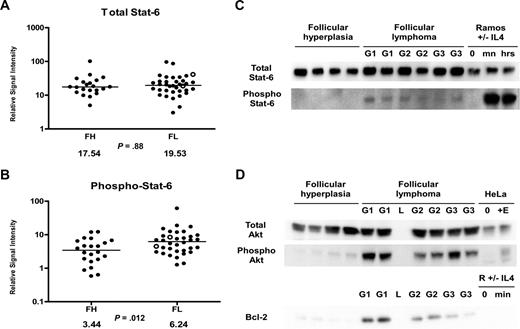 Figure 4. Stat-6 phosphorylation in FL and FH. (A,B) Tissue lysates of FL (N = 36) and FH (N = 22) were printed on RPMAs and probed with antibodies for Stat-6 (A) and phosphorylated Stat-6 on Tyr641 (B) as described in “Methods.” Scatterpoints represent relative signal intensity averaged over 3 runs and are depicted on a log10 scale. Median group values for FL and FH are designated with horizontal bars on the scatterplots and are listed beneath each plot, with the P value for comparison of the 2 groups. FL samples representing grade 3B are indicated by ○. (C) A total of 6 samples of FL (G1 indicates grade 1; G2, grade 2; G3, grade 3A) were compared with 4 samples of FH on Western blot, using antibodies for detection of total Stat-6 and phospho–Stat-6 Tyr641. Ramos cells untreated (0) and treated with IL-4 for 30 minutes (mn) and 24 hours (hrs) were used as negative and positive controls for Stat-6 activation. (D) A total of 6 samples of FL were compared with 4 samples of FH on Western blot, using antibodies for detection of total Akt, phospho-Akt Ser473, and Bcl-2. HeLa cell control lysates were used as described in Figure 3C.