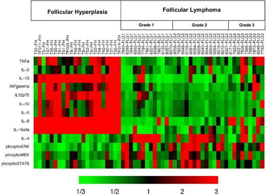Figure 5. Heatmap display of cytokine protein profiling and signaling protein analysis highlights the difference in patterns underlying distinct biologic processes embodied in FL and FH. Results are displayed for FL (N = 36) and FH (N = 22) samples. Heatmap depicts the “fold change” of the designated protein concentration of each specimen relative to the median value of the designated cytokine or signaling protein across all specimens. The color red indicates relatively high protein concentration and the color green indicates relatively low protein concentration.