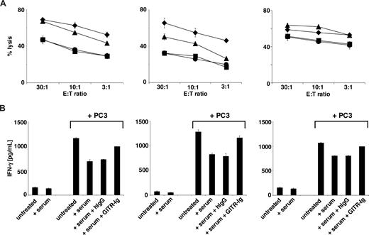 Figure 6. Effect of sGITRL contained in cancer patient sera on NK cell anti-tumor reactivity. (A) NK cells were incubated with PC3 tumor cells in the absence (diamonds) or presence of sGITRL-containing patient serum (squares). Where indicated, 10 ng/mL human IgG1 (circles) or GITR-Ig fusion protein (triangles) was added to patient serum 30 minutes before the cocultures. Cytotoxicity was analyzed by chromium release assays. (B) IFN-γ production of NK cells after 24 hours of culture alone or with PC3 cells in the absence or presence of patient serum and/or GITR-Ig with human IgG1 as control was determined by ELISA. (Left panels) Serum of a colon cancer patient. (Middle panels) Serum of lung cancer patient. (Right panels) Serum of a gastric cancer patient. Means of triplicates and SD of one representative experiment each of a total of at least 4 experiments with similar results are shown.