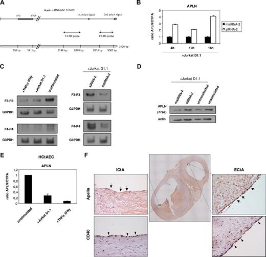 Figure 6. The endogenous vasoactive peptide apelin is strongly down-regulated through CD154 and other proinflammatory stimuli in ECs. (A) Schematic representation of the APLN full transcript (GenBank accession no. NM 017413) showing the coding sequence and the relative positions of the 2 polyadenylation sites within the 3′ noncoding sequence of the gene. The cDNA fragments (F3-R3 probe and F4-R4 probe) used to distinguish the alternative transcripts are also shown. (B) Relative APLN mRNA levels from msiRNA-2–treated (black columns) and siRNA-2–treated (white columns) HUVECs stimulated with Jurkat D1.1 (CD154+) cells for 4, 10, and 16 hours were assessed by real-time RT-qPCR using the housekeeping cyclophilin A gene (CYPA) as a control. Results are mean values plus or minus SEM from 2 independent experiments performed in triplicate. (C) Northern blot analysis of total RNA isolated from HUVECs either unstimulated, or stimulated with Jurkat D1.1 (CD154+) cells or with TNFα (100 U/mL) plus IFNγ (1000 U/mL) for 4 hours (left panels). Alternatively, HUVECs were treated with siRNA-2 or msiRNA-2 and further stimulated with Jurkat D1.1 (CD154+) T cells (right panels). All Northern blots were hybridized with the APLN-specific F3-R3 or F4-R4 probes as indicated, and a G3PDH probe was used for normalization. (D) At the protein level, cell extracts (40 μg of total protein/sample) from HUVECs either untransfected and unstimulated (lane 4), transfected with msiRNA-2, transfected with siRNA-2, or untransfected, and further stimulated for 4 hours with Jurkat D1.1 (CD154+) T cells (lanes 1, 2, and 3, respectively) were fractionated by 10% SDS-PAGE and probed with a 77–amino acid preproapelin-specific antibody. The housekeeping β-actin protein levels were assessed for lane normalization. (E) Relative APLN mRNA levels from HCtAECs either unstimulated, or stimulated with Jurkat D1.1 (CD154+) cells or with TNFα (100 U/mL) plus IFNγ (1000 U/mL) for 4 hours, were assessed by real-time RT-qPCR using the housekeeping cyclophilin A gene (CYPA) as a control. Results are mean values plus or minus SEM from 2 independent experiments performed in triplicate. (F) Apelin-36 immunostaining in human carotid arteries. A representative section from the carotid bifurcation showing the internal (ICtA) and external (ECtA) carotid arteries (central image: ×20). In the ICtA with advanced atheroma (type V lesion) there was almost absent apelin-36 immunostaining in the intraluminal ECs (). In the normal-looking ECtA, strong positive intraluminal EC immunostaining for apelin-36 was evident (). Both ICtA and ECtA presented significant endothelial CD40 immunoreactivity (). Peripheral images, ×400. The sections were computerized as color-encoded digitized images using a Nikon Eclipse 80i microscope equipped with a CFI Plan Fluor 4×/0.13 NA and 40×/0.75 NA air objectives, a Nikon DS-2Mv camera, and the DS-U2 image processing unit and analyzing software NIKON NIS-Elements version 3.21 (all Nikon, Melville, NY).