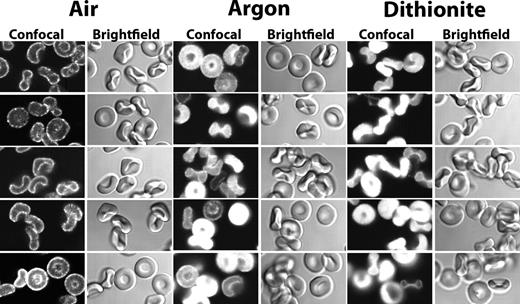 Figure 2. GE staining in oxygenated and in deoxygenated mouse erythrocytes. Confocal images of mouse erythrocytes after their staining for glycolytic enzymes under oxygenated (Air), deoxygenated with humidified argon (Argon), or deoxygenated with 10 mM of sodium dithionite (Dithionite) followed by humidified argon (“Preparation of cells”).