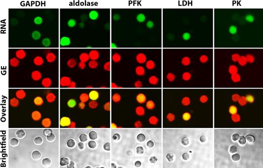 Figure 3. Localization of GEs in oxygenated band 3 knockout erythrocytes. Confocal images of band 3 null erythrocytes stained for both RNA (to identify reticulocytes, green stain) and GEs (red stain), as indicated. A merger of both stains is shown in the third row (overlay), and bright field images are displayed in the bottom row. Note that even the very few mature erythrocytes present (negative for SytoRNA stain, green color) do not show enzyme localization at the membrane.