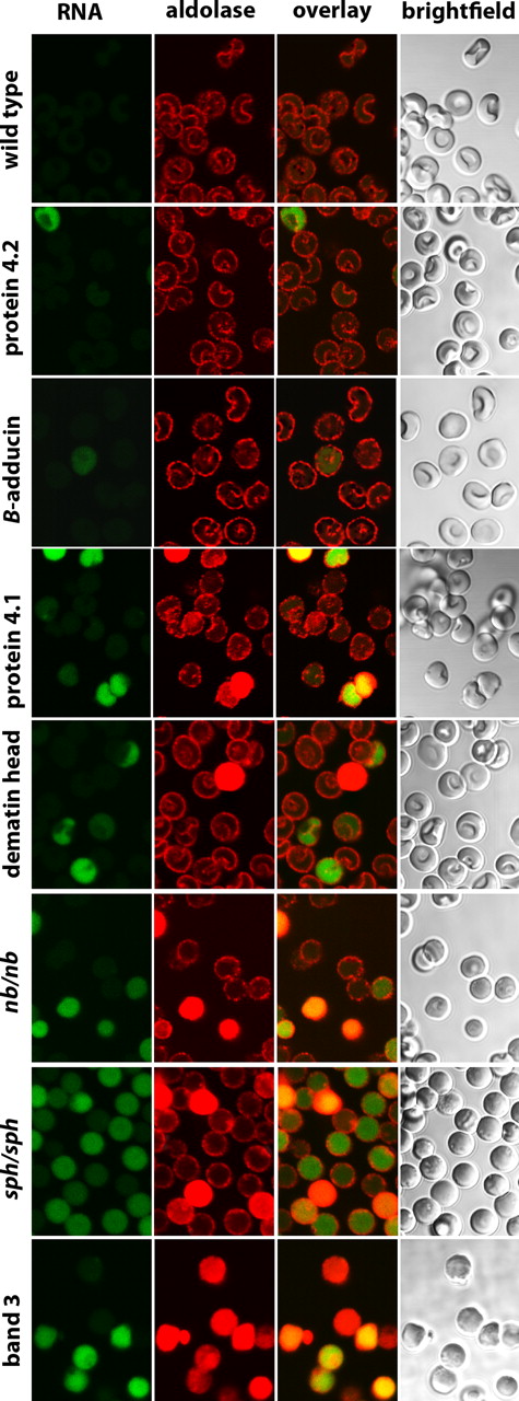 Figure 6. Distribution of aldolase in erythrocytes from mice deficient in major erythrocyte membrane proteins. Intact erythrocytes from wild-type mice and mice deficient in protein 4.2, β-adducin, protein 4.1, dematin headpiece domain, ankyrin (nb/nb), α-spectrin (sph/sph), and band 3 were fixed, permeabilized, and stained for aldolase and RNA, as described in “Methods.”