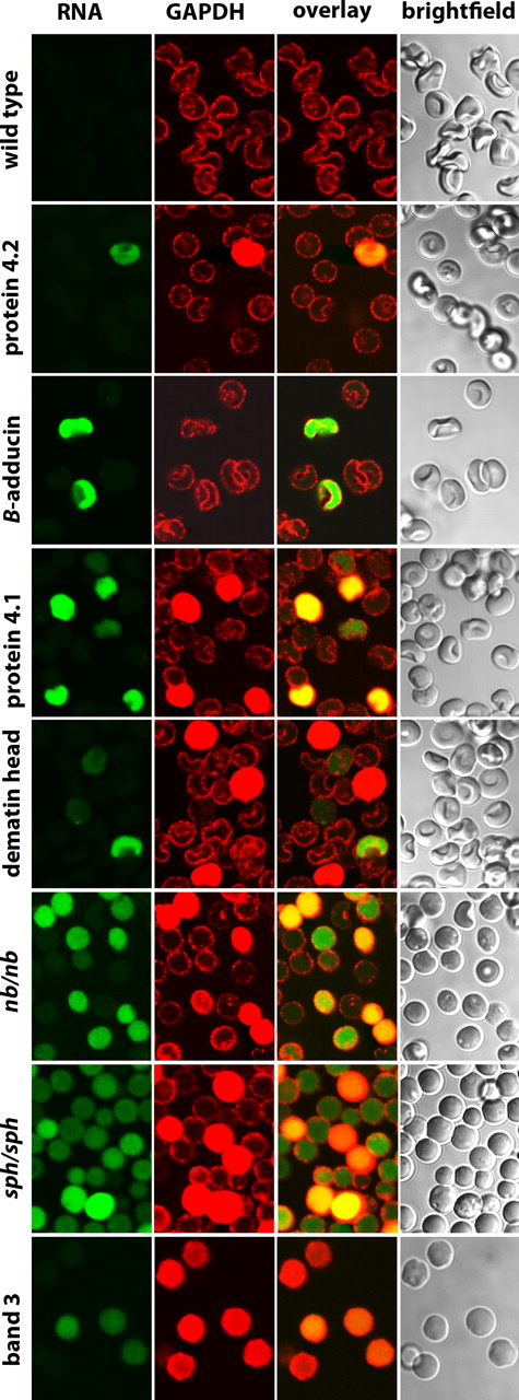 Figure 7. Distribution of GAPDH in erythrocytes from mice deficient in major erythrocyte membrane proteins. All conditions are identical to those in Figure 6, except that anti-GAPDH was used to stain the cells rather than antialdolase.