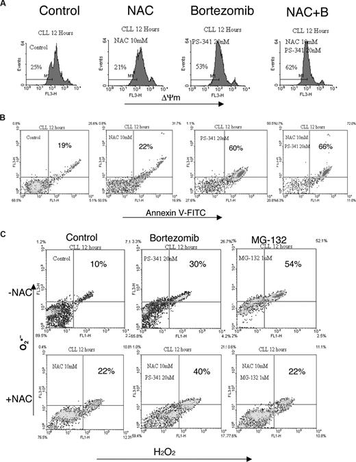 Figure 5. Effect of NAC on bortezomib-induced apoptosis. CLL cells were pretreated with 10 mM NAC for 2 hours and then incubated with 20 nM bortezmib or 1 μM MG-132 for 12 hours. ΔΨm (A), annexin V (B), and ROS (C) were determined by flow cytometry. The conditions for the experiment were similar to those described in Figure 4.