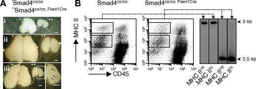 Figure 1. Inactivation of Smad4 in TECs causes thymic hypoplasia. (A) Representative photomicrographs of thymi from neonate (i), 5-week- (ii), and 20-week-old (iii) Smad4co/co (*) and Smad4co/co;Foxn1Cre (**) mouse littermates. Boxed area is shown in higher magnification to point out cysts in aged Smad4co/co;Foxn1Cre mice. Scale bars represent 1 mm. (B) Smad4 exon 9 deletion was verified in adult MHCIIint and MHCIIhi sorted TEC populations. Rectangles in the dot plots indicate sorting gates. Deletion was quantified by genomic PCR, yielding a 3-kb WT fragment and a 0.5-kb recombined fragment.
