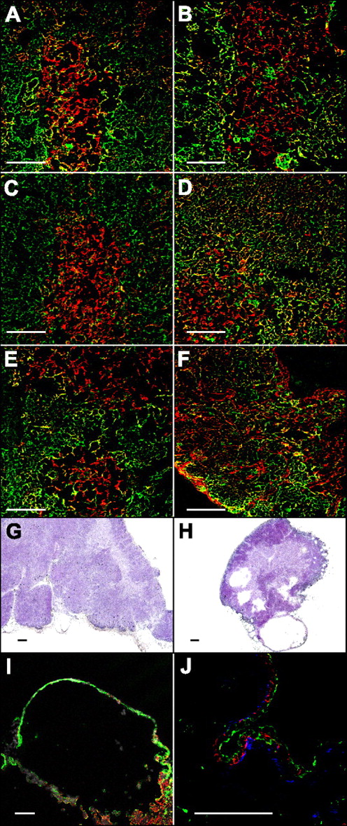 Figure 2. Disorganized thymic microenvironment in aged Smad4co/co;Foxn1Cre mice. Immunofluorescence analysis of thymi from neonatal (A,B), 6-week- (C,D), and 20-week-old mice (E,F) with a Smad4co/co (A,C,E) or Smad4co/co;Foxn1Cre (B,D,F) genotype stained for cytokeratin 5 (red) and cytokeratin 18 (green). Hematoxylin and eosin staining of thymi from 20-week-old Smad4co/co (G) or Smad4co/co;Foxn1Cre (H) mice. Detailed analysis of a cyst stained either (I) with cytokeratin 5 (green), cytokeratin 18 (red), and DAPI (white), or (J) with cytokeratin 5 (red), cytokeratin 18 (green), and ERTR7 (blue). Scale bars represent 100 μm.