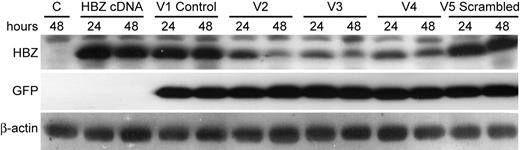 Figure 2. Hbz-specific shRNA lentiviral plasmid vectors knock down HBZ protein expression transiently. 293T cells (105) were cotransfected with 0.2 μg HBZ cDNA expression vector and 1.0 μg shRNA lentiviral vector as indicated (V1-V5). Cellular lysates were harvested at 24- and 48-hour time points and subjected to Western blot analysis to detect HBZ, GFP, and β-actin. β-actin and GFP levels were used as internal loading and transfection normalization controls, respectively.