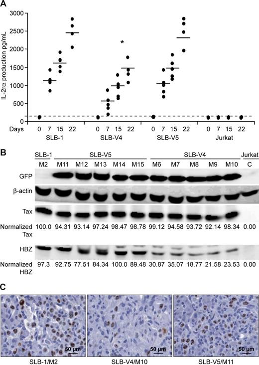 Figure 6. SLB-1 Hbz knockdown cell proliferation is significantly reduced in NOG mice. (A) NOG mice were inoculated with 107 parental SLB-1, stable lentiviral-infected SLB-1 derivatives (V4, V5), or Jurkat cell control (5 mice each). Because SLB-1 secretes IL-2Rα, mouse serum levels of IL-2Rα were measured by ELISA as a biomarker for SLB-1 proliferation in vivo. Each dot represents the average absorbance value of a single inoculated mouse at 0, 7, 15, and 22 days after inoculation within each group. The horizontal line represents the average of the mouse group at each weekly time point and the dotted line represents negative absorbance values. * denotes significant differences from controls. Statistical significance was determined by ANOVA followed by Tukey test. (B) Western blot analysis was performed on total tumor cell lysates of individual mice as indicated. HBZ and Tax levels were quantified and normalized to β-actin control by densitometry. Statistical significance was determined by ANOVA followed by Tukey test. (C) Immunohistochemistry was performed on representative mouse liver tissue stained for Ki67 human antigen, a marker for proliferation. The glass slides were digitally scanned and captured at 40× magnification using the Aperio ScanScope and ImageScope Software (Aperio Technologies. Vista, CA). Average liver counts for each group are: SLB-1, 389.25 (n = 4); SLB-V4, 97.75 (n = 4); and SLB-V5, 358.6 (n = 5).