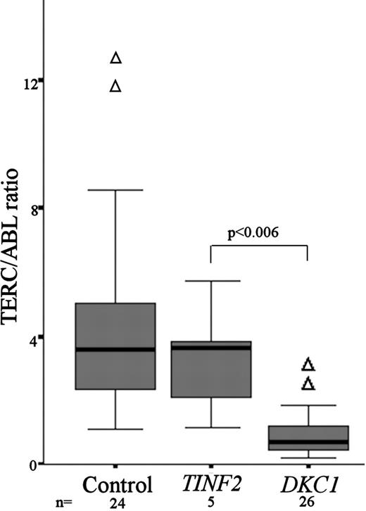 Figure 3. TERC/ABL levels are not reduced in patients with DC with TINF2 mutations. Comparison of TERC/ABL levels between healthy controls (n = 24), patients with DC with TINF2 mutations (n = 5), and patients with DC with DKC1 mutations (n = 26). The P value between TERC/ABL levels for TINF2 and DKC1 patients is given. The box represents the interquartile range which contains the 50% of values. The whiskers are lines that extend from the box to the highest and lowest values, excluding outliers (△). A line across the box indicates the median.