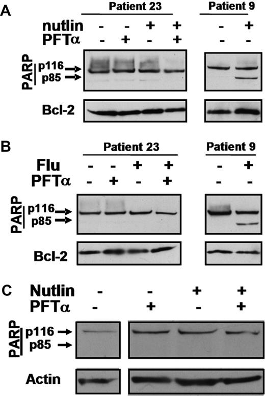 Figure 7. Actions of PFTα in cells from a p53-dysfunctional patient and in normal T lymphocytes. Cells from p53-dysfunctional patient 23 were incubated with 10 μM nutlin 3a (A) or 10 μM fludarabine (B). PFTα (25 μM) was added as shown. Whole cell lysates were analyzed by Western blotting. Cell extracts from patient 9 were included as controls to identify the migration positions of p116 and p85 PARP bands. The complete lack of a p53 response by the cells of this patient are documented in Figure S3. (C) Western blot analysis of PARP in normal T lymphocytes incubated with PFTα and/or nutlin. Similar results were obtained in 2 additional experiments.