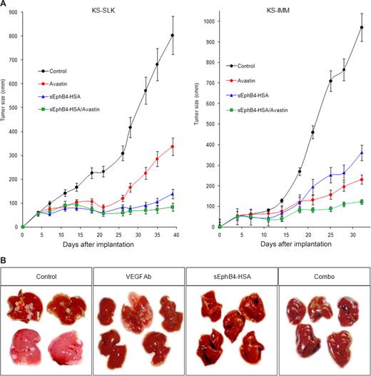Figure 4. sEphB4-HSA inhibits KS tumor growth in a murine tumor xenograft model. (A) Mice (n = 8/group) were implanted with 2 × 106 KS-SLK or KS-IMM cells and treated with sEphB4-HSA, VEGF moAb, or combination sEphB4-HSA/VEGF moAb; tumor volumes were measured 2 times a week; and the data are presented as tumor volume. After 5 weeks, tumor volumes were as follows; sEphB4-HSA (KS-SLK = 15.9% of control, P < .001; KS-IMM = 37.2% of control, P < .001) or combination sEphB4-HSA plus VEGF moAb (KS-SLK = 12.1% of control, P < .001; KS-IMM = 12.6% reduction, P < .001). (B) Mice spleens were injected with 106 SLK cells and treated with sEphB4-HSA, VEGF moAb, or combination sEphB4 plus VEGF moAb. After 5 weeks, livers were harvested and examined for the number of tumor metastases (tumors/livers) and are as follows; control (8/11), VEGF moAb (2/5), sEphB4-HSA (2/5), and combination of sEphB4-HSA and VEGF moAb (0/5).