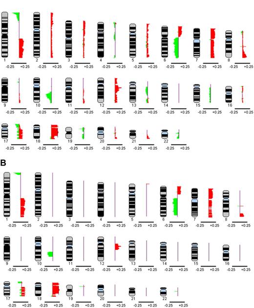 Figure 1. Composite frequency ideogram plot of genome-wide copy number alterations in 106 diagnostic FL cases based on intersection analysis. (A) The frequencies of aberrations, represented by green signals for losses and red signals for gains, in the autosomes were derived from intersection analysis, where the union was taken between calls made visually by a cytogenetic pathologist and those determined by CNA-HMMer version 0.1. (B) Composite frequency ideogram plot showing only those aberrations affecting at least 10% of cases. The data were visualized using the SeeGH software. Genetic losses or gains are represented by green and red signals, respectively. The horizontal bar below each ideogram represents gain and loss frequencies of +0.25 and −0.25, respectively.