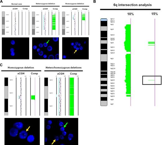 Figure 3. Array CGH and FISH correlation of 1p36.3 and 6q23.3. (A) FISH validation of the 1p36.22-p36.33 region (ID no. 1), which presented significant correlation with clinical outcome. Array CGH (top panel) and FISH (bottom panel) demonstrating a case without deletion at 1p36.3 (normal), a case with heterozygous deletion at 1p36.3, and a case with homozygous deletion at 1p36.3. The 1p36.32 probe was labeled red, while the control probe at 1q32 was labeled green. (B) A composite-array CGH ideogram profile of 6q alterations affecting at least 10% and at least 15% of FL cases was generated by intersection analysis. The alteration indicated by the black box in the 15% ideogram corresponds to the 6q23.3 region targeted for FISH validation. (C) FISH validation of the 6q23.3 region (ID no. 20), which presented significant correlation with clinical outcome. Array CGH (top panel) and FISH (bottom panel) demonstrating a case with homozygous deletion and a case with homozygous deletion at 6q23.3 and proximal and distal heterozygous deletion. The 1p36.3 and 6q23.3 probes were labeled red, while the control probes at 1q32.3 and 6p12.3 were labeled green. Green arrows in FISH indicate the presence of heterozygous deletion, while yellow arrows indicate the presence of homozygous deletion. For array CGH, each dot represents a BAC clone and the light blue lines represent visual calling of aberrations. Loss is indicated by a shift to the left of center and gain by a shift to the right of center. Vertical lines are −1 and + 1 scale bars of log2 ratios. “Comp” refers to the HMM computational analysis of aberration frequency.