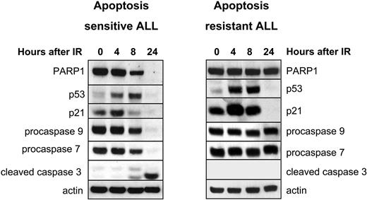 Figure 1. Profiling of in vitro IR response in ALL by Western blotting identifies apoptosis-sensitive and apoptosis-resistant tumors. Left panel shows a representative IR-sensitive ALL exhibiting gradual cleavage of PARP1 and disappearance of full-size PARP1 protein by 24 hours after 5 Gy IR. This is accompanied by up-regulation of p53 protein and its target p21 between 4 and 8 hours after IR, cleavage and disappearance of full-length proteins procaspase-9 and -7, and occurrence of the cleaved caspase-3 by 24 hours after IR. Right panel shows a representative IR-resistant ALL, exhibiting absence of cleavage of PARP1 and procaspase-9, -7, and -3 by 24 hours after 5 Gy IR despite abundant up-regulation of proteins p53 and p21 between 4 and 8 hours after IR. Expression of actin shows equal protein loading. The same Western blot for either representative IR-sensitive or IR-resistant ALL was reprobed with different antibodies multiple times. For each of the tumors, each horizontal group of lanes represents probing with a single antibody, and these individual probings are separated by black boxes.