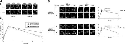 Figure 6. Kinetics of IR-induced γH2AX suggests more efficient DNA DSB repair in apoptosis-resistant ALLs. (A) (i) Following treatment with 2 Gy of IR and induction of a comparable number of DNA DSBs measured by γH2AX/MDC1 foci at 30 minutes, by 4 hours the resistant ALL 102 shows more efficient DNA repair and resolution of these foci, whereas sensitive ALL 114 retains foci at the same time point. Primary antibody binding was detected using Alexa Fluor 488 and Alexa Fluor 594–labeled secondary antibodies. Images were captured with a Nikon Eclipse E600 microscope (100×/1.40 NA oil objective) with a Hamamatsu digital camera C4742-95 and Volocity 4.2 software. (ii) Percentage of cells with more than 5 γH2AX/MDC1 foci 4 hours after IR is significantly higher in sensitive ALL 114 compared with resistant ALLs 102 and 106 (P = .04 and .02, respectively). The number of foci per cell was counted in 150 to 200 cells in randomly selected fields. The data are expressed as a percentage of cells with greater than 5 foci and the error bars represent the standard deviation from 3 independent counts. (B) Addition of PI3-kinase inhibitor LY294002 significantly delays disappearance of IR-induced foci at 4 hours after IR with 2 Gy in resistant tumor 102 (bottom panel), but shows no effect on resolution of foci in apoptosis-sensitive ALL 114 at the same time point (top panel).