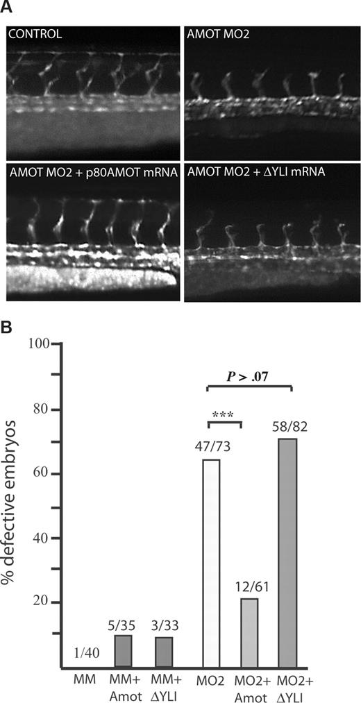 Figure 1. The PDZ-binding motif is essential for restoring endothelial migration in Amot knockdown in zebrafish. Zebrafish embryos (transgenic for fli:GFP visualizing endothelial cells of the developing vasculature) were injected with combinations of a morpholino against Amot and mRNA transcripts from human p80Amot or human p80 with the last 3 amino acids in the PDZ-binding motif deleted (ΔYLI). (A) Fluorescent images of zebrafish 32 hours after fertilization. Embryos were injected with morpholinos and mRNA as indicated in the figure. (B) Bar diagram showing statistics of the percentage of embryos with vascular defects. MM indicates mismatched control morpholino; MO2, morpholino targeting exon 2 of Amot; Amot, human p80Amot mRNA; and ΔYLI, human p80 mRNA with the PDZ-binding motif deleted. ***P < .001.