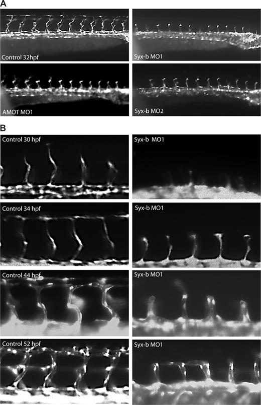 Figure 6. Syx-b and amot morphants show a common ISV phenotype. (A) Knockdown of zebrafish syx-b using 2 nonoverlapping morpholinos, MO1 and MO2, resulted in identical ISV migration defects. The sprouts in syx-b MO arrest at the horizontal myoseptum. (B) In syx-b morphants, outgrowth of the ISV tip cells was delayed. With time, defective ISVs appear to form lumens that are capable of anastomosing with neighboring vessels. The truncated ISV phenotype was observed in embryos after 52 hours after fertilization (hpf). Due to the severity of the phenotype, the dorsal longitudinal anastomosing vessel (DLAV) does not form. In all panels, anterior is to the left and dorsal is to the top.