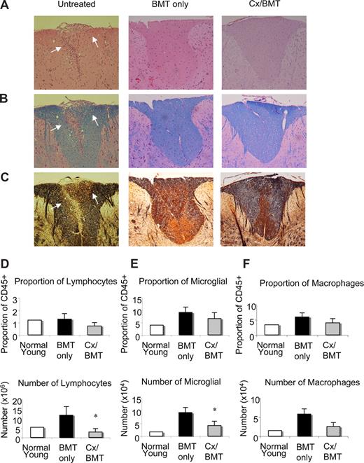 Figure 2. BMT leads to a reduction in infiltrates, demyelination, and axonal damage in the CNS. Representative spinal cord sections from untreated EAE mice, mice undergoing BMT, or mice undergoing BMT in combination with castration 12 days after EAE induction. Sections stained with (A) hematoxylin and eosin for infiltration, (B) Luxol fast blue for demyelination, and (C) Bielschowsky silver impregnation for axonal damage illustrating that EAE mice treated with either BMT only or BMT in combination with castration had little or no inflammatory infiltrates, demyelination, and axonal damage compared with untreated EAE mice. (D) Flow cytometric analysis of infiltrating lymphocytic population as described by CD45+CD4+CD11b− surface marker staining. Whereas proportions of infiltrating lymphocytes did not alter, their number significantly decreased in Cx/BMT mice. (E) Microglia cell analysis by flow cytometric analysis, as determined by CD45lo CD11b+ cell surface staining, demonstrated a significant reduction in the number of activated microglia cells in Cx/BMT-treated mice than the BMT-only mice, however proportions remain unchanged. (F) Macrophage and granulocyte populations in the CNS as examined by flow cytometric analysis of the CD45hiCD11b+ population. Graphed results indicate that there was no significant alteration between treatment groups in proportion and cellularity. Results are expressed as mean plus or minus SEM from 2 or more independent experiments. *P < .05 versus BMT only. Original magnification ×60.