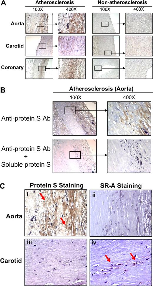 Figure 7. Protein S and SR-A immunoreactivity of human atherosclerotic and nonatherosclerotic arteries. Human aorta, and carotid and coronary arteries were fixed in formalin and embedded in paraffin. Immunostaining was performed using the antihuman protein S antibody (1:200), antihuman SR-A antibody (1:100), biotinylated secondary antibody, and avidin-biotin reaction using peroxidase enzyme. Brown color represents positive staining of protein S or SR-A. (A) Protein S immunoreactivity in human aorta, and carotid and coronary arteries. Nonimmune rabbit IgG was used as negative controls. (B) Soluble protein S blocked immunostaining with anti–protein S antibody in human aorta. Anti–protein S antibody was preincubated with soluble protein S before adding to the slides. (C) Localization of protein S and SR-A immunoreactivity in serial sections of human aorta and carotid artery (magnification ×400). (i) Protein S immunostaining (positive area) for an atherosclerotic region of human aorta. (ii) SR-A immunostaining (negative area) for an atherosclerotic region of human aorta. (iii) Protein S immunostaining (negative area) for an atherosclerotic region of human carotid artery. (iv) SR-A immunostaining (positive area) for an atherosclerotic region of human carotid artery. Red arrows indicate positive staining.