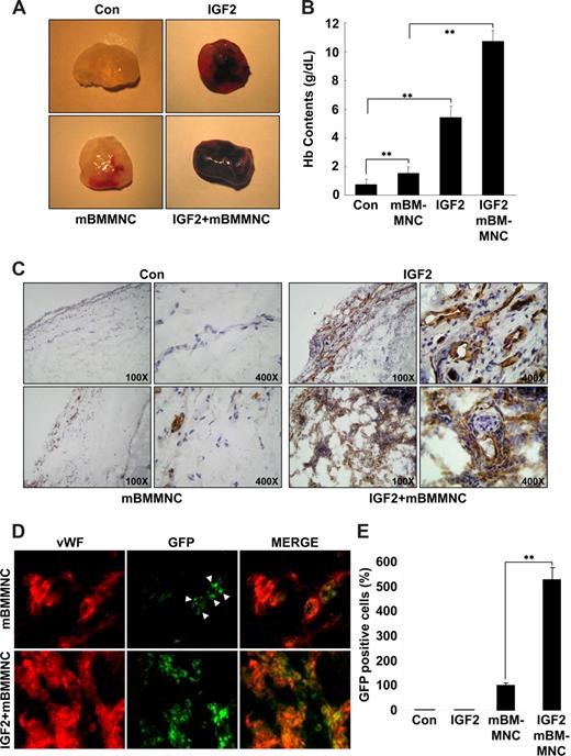 Figure 6. IGF2 increases mBMMNC homing and neovascularization in the mouse Matrigel plug assay. C57BL/6 mice were injected with 0.6 mL Matrigel with or without IGF2 (200 ng) (n = 7 per group). After 1 day, CD34+ mBMMNCs from EGFP transgenic mice (5 × 105/mouse) were infused into the tail vein. Six days after infusion, mice were killed, and Matrigel plugs were excised and serially sectioned. (A) Representative Matrigel plugs. (B) Quantification of neovasculature formation by measuring hemoglobin levels in the Matrigel. (C) Plug sections were stained for infiltrating endothelial cells using anti-CD31antibody (Olympus CX31 RBSF microscope; 10×/0.25 NA and 40×/0.65 NA plan objectives). (D) Plug sections were used to identify ECs with anti-VWF antibody (red) and mBMMNCs with green fluorescence (Olympus IX81-ZDC microscope, LUCPL FLN 40×/0.60 NA lens). (E) Quantitative assessment of GFP+ mBMMNCs per field for each Matrigel sample. Data are the mean plus or minus SE. **P < .01 versus each mouse group.