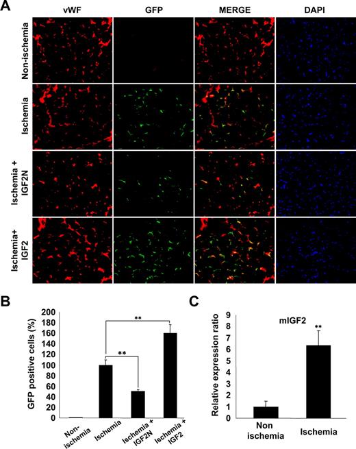 Figure 7. IGF2 increases in vivo homing of mBMMNCs in sites of hind limb ischemia. After the ligature was performed on the proximal origin of the right femoral artery (n = 6 per group), CD34+ mBMMNCs isolated from EGFP transgenic mice (5 × 105/mouse) were infused into the tail vein. Mouse IGF2 neutralizing antibody (IGF2N, 20 μg) or mouse IGF2 (250 ng) was administered to the ischemic area 30 minutes before cell transplantation. One day after infusion, the medial section of the thigh muscle was frozen and sectioned (10 μm) at 200-μm intervals. (A) Mouse vasculature was stained with anti–mouse VWF antibody (red fluorescence). Nuclei were stained with DAPI (blue fluorescence). Images were viewed using an Olympus IX81-ZDC microscope with a LUCPL FLN 20×/0.45 NA lens. (B) GFP+ mBMMNCs were counted in each section under fluorescent microscopy. Total cell number was divided by total muscle area, which was measured using Image-Pro Plus. (C) Real-time analysis of IGF2 transcript abundance in ischemic muscle. Data are the mean plus or minus SE. **P < .01 versus each mouse group.