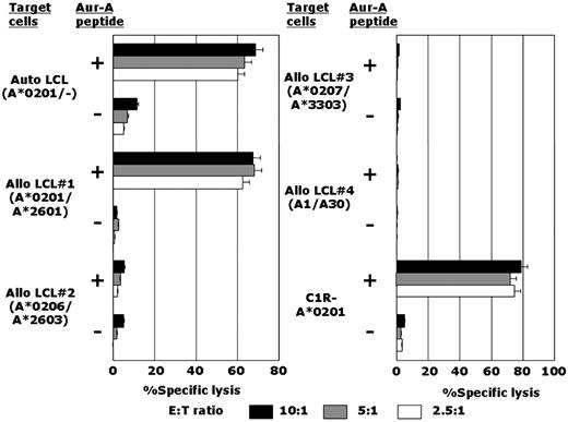 Figure 1. Establishment of an HLA-A*0201–restricted and Aur-A207-215 peptide–specific CTL line, AUR-1. The cytotoxicity of the CTL line designated AUR-1 against various LCLs and HLA-A*0201 gene–transfected cells (C1R-A*0201), which were loaded or unloaded with Aur-A207-215 peptide, was determined by 4-hour 51Cr-release assays at effector-to-target (E:T) ratios of 10:1, 5:1, and 2.5:1.