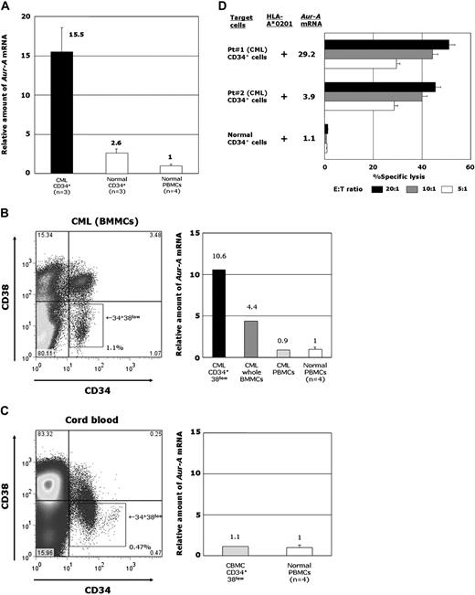 Figure 4. Expression of Aur-A in CD34+CD38low fractions of CML cells and normal hematopoietic progenitor cells, and cytotoxicity of AUR-1 against CD34+ CML cells and CD34+ normal hematopoietic stem cells. (A) Expression levels of Aur-A mRNA in CD34+ cells isolated from BMMCs of patients with CML, CD34+ cells isolated from normal BMMCs and CBMCs, and normal PBMCs. Expression levels of Aur-A mRNA in leukemic CD34+ cells, normal hematopoietic stem cells, and normal PBMCs were determined using 3 samples of CML BMMCs, 1 sample of normal BMMCs, 2 samples of CBMCs, and 4 samples of normal PBMCs. The level of Aur-A mRNA in normal PBMCs is shown as 1.0 and the expression levels in samples were calculated relative to this value. (B) Representative data of Aur-A mRNA expression in the CD34+CD38low fraction of BMMCs, whole BMMCs, and PBMCs isolated from a patient with CML in chronic phase and PBMCs isolated from 4 healthy individuals. The CD34+CD38low cells were collected using a cell sorter. (C) Representative data of Aur-A mRNA expression in the CD34+CD38low fraction of CBMCs isolated from a normal donor and PBMCs isolated from 4 healthy individuals. The CD34+CD38low cells were collected using a cell sorter. (D) Cytotoxicity of AUR-1 against CD34+ leukemia progenitor cells and normal CD34+ hematopoietic progenitor cells. The cytotoxicity of AUR-1 against CD34+ leukemia cells isolated from 2 HLA-A*0201–positive patients with CML and normal CD34+ hematopoietic progenitor cells isolated from an HLA-A*0201–positive cord blood donor was determined by 51Cr-release assays at E/T ratios of 20:1, 10:1, and 5:1. Expression levels of Aur-A mRNA in samples are also shown.