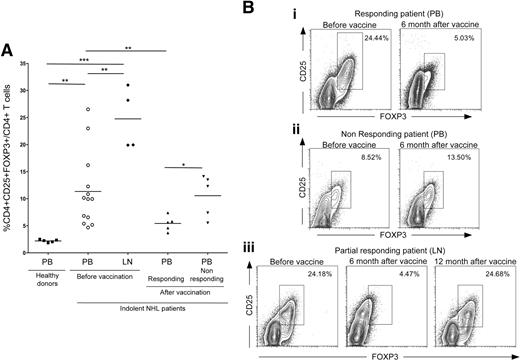 Figure 2. Evaluation of Treg frequency in PB and LN of NHL patients before and after vaccination. (A) Schematic comparison of CD4+CD25+FOXP3+ T-cell frequencies in healthy donor PB, patient PB and LNs before vaccination, and responding and nonresponding patient PB after vaccination. Statistically significant differences, by 2-sided Student t test, are reported (*P ≤ .05; **P ≤ .01; ***P ≤ .001). (B) Representative examples of Treg frequencies in prevaccination versus postvaccination PB of the complete responding patient no. 14 (i), the nonresponding patient no. 7 (ii), and LN specimens collected before vaccination, 6 months after vaccination at the time of partial remission, and 12 months after vaccination at disease progression from the partial responding patient no. 5 (iii). All plots were gated on CD3+CD4+ cells. Data were acquired using BD CellQuest software version 3.3 on the 4-color analysis flow cytometer BD FACSCalibur (Becton Dickinson, Lincoln Park, NJ). Analyses were performed using FlowJo 8.7.1 software version for Macintosh (TreeStar, Eugene, OR).
