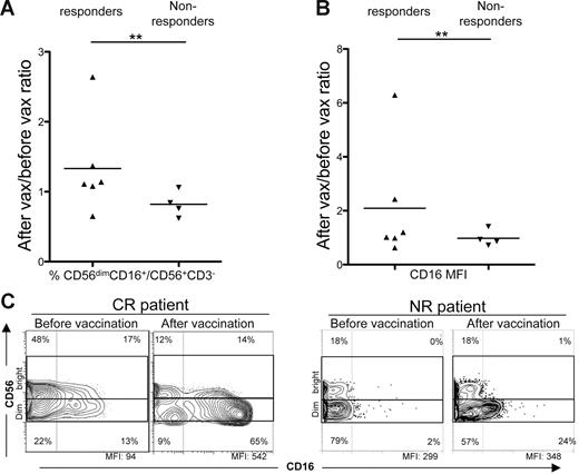 Figure 3. Evaluation of CD56dimCD16+ NK frequency in NHL patient PB before and after vaccination. (A) Ratios of CD56dimCD16+ NK frequencies in postvaccination versus prevaccination PB samples of responders and nonresponders.(B) Ratios of CD16 MFI in NK cells of postvaccination versus prevaccination PB samples of responders and nonresponders. Statistically significant differences were calculated using the Fisher exact test (**P ≤ .01). (C) Representative examples of CD56dimCD16+ NK frequencies in prevaccination versus postvaccination PB of a complete responder (left panels, patient no. 14), and of a nonresponder (right panels, patient no. 7). All plots were gated on CD3−CD56+ cells. Data were acquired using BD CellQuest software version 3.3 on the 4-color analysis flow cytometer BD FACSCalibur. Analyses were performed using FlowJo 8.7.1 software version for Macintosh.