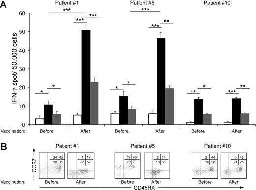 Figure 4. Functional and phenotypic analysis of T cells at tumor site from partial responding or nonresponding patients. (A) T cells, isolated from involved LNs before and after vaccination, were evaluated by IFN-γ ELISPOT assay when cultured alone (□), with the autologous tumor (■), or with an allogeneic tumor (). Results obtained for 2 of 3 partial responders and for a nonresponder patient are reported. Error bars indicate standard deviation of the mean. Statistically significant differences, by 2-sided Student t test, are reported (*P ≤ .05; **P ≤ .01; ***P ≤ .001). (B) Maturation profile of T cells at tumor site before and after vaccination was assessed by flow cytometry analysis of CCR7 and CD45RA expression in the CD3+CD8+ gated population. Data were acquired using BD CellQuest software version 3.3 on the 4-color analysis flow cytometer BD FACSCalibur. Analyses were performed using FlowJo 8.7.1 software version for Macintosh.
