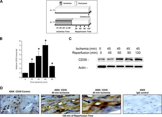 Figure 3. Induction of cardiac CD39 during murine myocardial ischemia in vivo. (A) Murine model of cardiac ischemia. To study in vivo expression of cardiac CD39 during cardiac ischemia, we exposed mice to in vivo coronary artery ligation (B) over indicated time periods (0-60 minutes) followed by 2 hours of reperfusion or (C) exposed mice to 45 minutes of coronary ischemia followed by indicated time periods of reperfusion. A indicates anesthesia induction; T, thoracotomy. (B) CD39 transcript from myocardial biopsies of the area at risk. C57BL/6 mice were subjected to myocardial ischemia over 0 to 60 minutes of ischemia followed by 2 hours of reperfusion, and cardiac tissue from the area at risk was excised, flash frozen, and CD39 transcript levels were determined by real-time RT-PCR. Data were calculated relative to an internal housekeeping gene (β-actin) and are expressed as fold change compared with control (0 minutes of myocardial ischemia ± SEM at each indicated time, n = 6; *P < .01). (C) C57BL/6 mice were subjected to 45 minutes of in situ ligation of the left coronary artery, and myocardial tissue from the area at risk was excised after indicated reperfusion times (0-120 minutes), lysed, proteins resolved by sodium dodecyl sulfate–polyacrylamide gel electrophoresis (SDS-PAGE), and transferred to nitrocellulose. Membranes were probed with CD39 antibody. The same blot was probed for β-actin expression as a control for protein loading. One representative experiment of 3 is shown. (D) C57BL/6 mice were subjected to 45 minutes of myocardial ischemia, and cardiac tissue from the area at risk was harvested after 120 minutes of reperfusion, sectioned, and stained using CD39 antibody. Cardiac tissue from sham-operated mice served as control (original magnification ×400 or ×800, as indicated). To control for nonspecific staining, IgG was used at identical concentrations and staining conditions as the target primary antibodies for CD39.