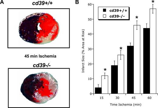 Figure 4. Influence of CD39 on cardiac ischemia-reperfusion injury. CD39−/− or littermate controls matched by age and sex (CD39+/+) were exposed to 15 to 60 minutes of coronary ischemia via in situ ligation of the left coronary artery and were killed after 2 hours of reperfusion. Infarct sizes were measured by double staining with Evan blue and 2,3,5-triphenyltetrazolium chloride (TTC). (A) Representative images of infarcts from the experiment are displayed (blue represents retrograde Evan blue staining; red and white, area at risk; white, infarcted tissue). (B) Infarct sizes expressed as the percentage of the area at risk that underwent infarction (mean ± SD, n = 6). *P < .05 compared to wild-type mice (cd39+/+).